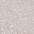 Immunohistochemical staining of human liver shows negative to very weak positivity in hepatocytes as expected.