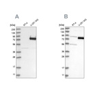 Western blot analysis using Anti-COLGALT2 antibody HPA031750 (A) shows similar pattern to independent antibody HPA031749 (B).