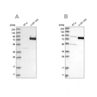 Western blot analysis using Anti-COLGALT2 antibody HPA031750 (A) shows similar pattern to independent antibody HPA031749 (B).