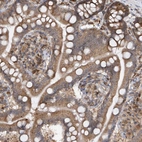 Immunohistochemical staining of human small intestine shows moderate cytoplasmic-membranous positivity in glandular cells.