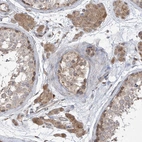 Immunohistochemical staining of human testis shows moderate cytoplasmic positivity in leydig cells and weak cytoplasmic positivity in cells in seminiferous duct.