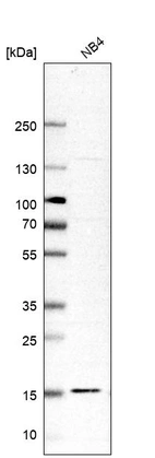 Western blot analysis in human cell line NB4.