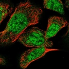 Immunofluorescent staining of human cell line A-431 shows localization to nucleoplasm & cytosol.