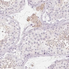 Immunohistochemical staining of human testis shows moderate cytoplasmic positivity in Leydig cells.