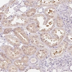 Immunohistochemical staining of human kidney shows moderate cytoplasmic positivity in cells in tubules.