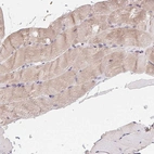 Immunohistochemical staining of human skeletal muscle shows weak cytoplasmic positivity in myocytes.