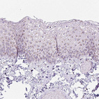 Immunohistochemical staining of human skin shows strong cytoplasmic granular positivity in squamous epithelial cells.