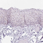 Immunohistochemical staining of human skin shows strong cytoplasmic granular positivity in squamous epithelial cells.
