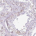 Immunohistochemical staining of human testis shows moderate cytoplasmic granular positivity in cells in seminiferous ducts.