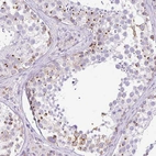 Immunohistochemical staining of human testis shows moderate cytoplasmic granular positivity in cells in seminiferous ducts.