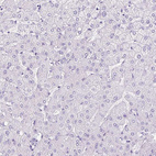 Anti-GOLGA8A Antibody