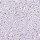 Immunohistochemical staining of human liver shows no positivity in hepatocytes as expected.