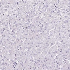 Immunohistochemical staining of human liver shows no positivity in hepatocytes as expected.