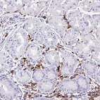 Immunohistochemical staining of human stomach shows strong cytoplasmic-membranous positivity in lymphoid cells.