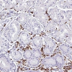 Immunohistochemical staining of human stomach shows strong cytoplasmic-membranous positivity in lymphoid cells.