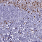 Immunohistochemical staining of human tonsil shows strong cytoplasmic-memb positivity in non-germinal center cells.