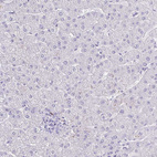 Immunohistochemical staining of human liver shows negative positivity in hepatocytes as expected.