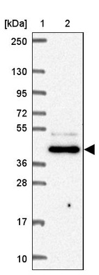 Lane 1: Marker [kDa] 250, 130, 95, 72, 55, 36, 28, 17, 10_br/_Lane 2: Human cell line RT-4