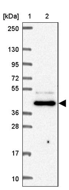 Lane 1: Marker [kDa] 250, 130, 95, 72, 55, 36, 28, 17, 10_br/_Lane 2: Human cell line RT-4