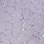Immunohistochemical staining of human skeletal muscle shows no positivity in myocytes as expected.