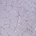 Immunohistochemical staining of human skeletal muscle shows no positivity in myocytes as expected.