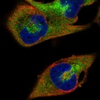 Immunofluorescent staining of human cell line RH-30 shows localization to cytosol.