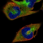Immunofluorescent staining of human cell line RH-30 shows localization to cytosol.
