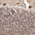 Immunohistochemical staining of human cerebellum shows moderate cytoplasmic-membranous positivity in Purkinje cells.