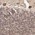 Immunohistochemical staining of human cerebellum shows moderate cytoplasmic-membranous positivity in Purkinje cells.