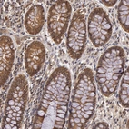 Immunohistochemical staining of human rectum shows moderate cytoplasmic-membranous positivity in glandular cells.