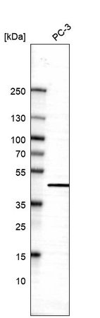 Western blot analysis in human cell line PC-3.