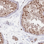 Immunohistochemical staining of human testis shows moderate nuclear-cytoplasmic positivity in cells in seminiferous ducts and leydig cells.