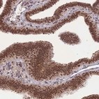 Immunohistochemical staining of human fallopian tube shows moderate nuclear-cytoplasmic positivity in glandular cells.