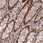 Immunohistochemical staining of human colon shows strong nuclear-cytoplasmic positivity in glandular cells.