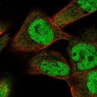 Immunofluorescent staining of human cell line RH-30 shows localization to nucleoplasm & cytosol.
