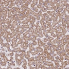 Immunohistochemical staining of human liver shows moderate positivity in cytoplasm granular in hepatocytes.