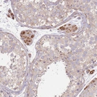 Immunohistochemical staining of human testis shows moderate positivity in cytoplasm granular in leydig cells and weak positivity in cells in seminiferous duct cells.