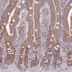 Immunohistochemical staining of human duodenum shows moderate positivity in cytoplasm granular in glandular cells.