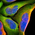 Immunofluorescent staining of human cell line U-2 OS shows localization to cytosol.