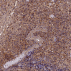 Immunohistochemical staining of human tonsil shows moderate cytoplasmic and nucleus positivity in germinal center cells.