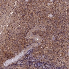 Immunohistochemical staining of human tonsil shows moderate cytoplasmic and nucleus positivity in germinal center cells.