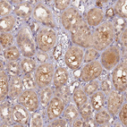 Immunohistochemical staining of human kidney shows moderate cytoplasmic and weak nucleus positivity in cells in tubules.