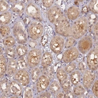 Immunohistochemical staining of human kidney shows moderate cytoplasmic and weak nucleus positivity in cells in tubules.
