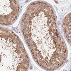Immunohistochemical staining of human testis shows moderate cytoplasmic and nucleus positivity in cells in seminiferous ducts.