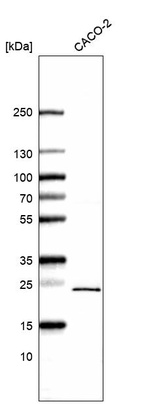 Western blot analysis in human cell line CACO-2.
