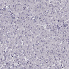 Immunohistochemical staining of human liver shows no positivity in hepatocytes as expected.