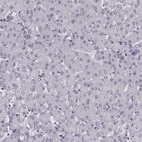 Immunohistochemical staining of human liver shows no positivity in hepatocytes as expected.