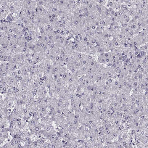 Anti-TTC25 Antibody