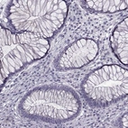 Immunohistochemical staining of human rectum shows no positivity in glandular cells as expected.