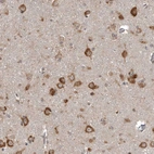 Immunohistochemical staining of human cerebral cortex shows strong cytoplasmic positivity in neuronal cells.